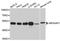 Rho GTPase Activating Protein 1 antibody, STJ22672, St John