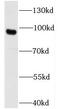 Unc-5 Netrin Receptor A antibody, FNab09261, FineTest, Western Blot image 