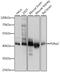 Pyruvate Dehydrogenase E1 Alpha 2 Subunit antibody, 15-822, ProSci, Western Blot image 