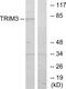Tripartite Motif Containing 3 antibody, PA5-38542, Invitrogen Antibodies, Western Blot image 