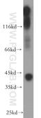 Potassium Voltage-Gated Channel Subfamily J Member 10 antibody, 12503-1-AP, Proteintech Group, Western Blot image 