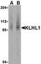 Amphiphysin antibody, orb19251, Biorbyt, Western Blot image 