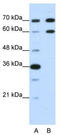 Doublesex And Mab-3 Related Transcription Factor 2 antibody, TA345619, Origene, Western Blot image 