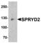 Cardiomyopathy Associated 5 antibody, MBS150809, MyBioSource, Western Blot image 