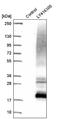 Uroplakin 1B antibody, NBP1-80656, Novus Biologicals, Western Blot image 