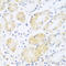 Complement C5 antibody, A00156, Boster Biological Technology, Immunohistochemistry paraffin image 