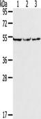 Matrix Metallopeptidase 23B antibody, TA351406, Origene, Western Blot image 