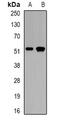 Calcium-binding and coiled-coil domain-containing protein 2 antibody, abx141399, Abbexa, Western Blot image 
