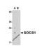 Suppressor Of Cytokine Signaling 1 antibody, 3765, ProSci Inc, Western Blot image 