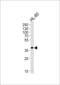 Haptoglobin-related protein antibody, 55-637, ProSci, Western Blot image 