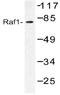 Raf-1 Proto-Oncogene, Serine/Threonine Kinase antibody, AP20499PU-N, Origene, Western Blot image 
