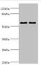 Estrogen Receptor 2 antibody, A53738-100, Epigentek, Western Blot image 