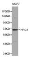 Sphingosine-1-Phosphate Receptor 5 antibody, LS-C192259, Lifespan Biosciences, Western Blot image 
