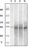RAB25, Member RAS Oncogene Family antibody, AM06107PU-N, Origene, Western Blot image 