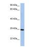 Crystallin Beta A1 antibody, NBP1-52907, Novus Biologicals, Western Blot image 