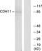 Cadherin 11 antibody, TA313601, Origene, Western Blot image 