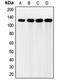 FGFR-2 antibody, MBS821068, MyBioSource, Western Blot image 