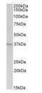 Annexin A1 antibody, orb20132, Biorbyt, Western Blot image 