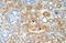 Serine palmitoyltransferase 1 antibody, ARP46721_P050, Aviva Systems Biology, Immunohistochemistry paraffin image 