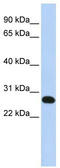 Protein-lysine methyltransferase METTL21A antibody, TA340404, Origene, Western Blot image 