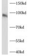 Axin 1 antibody, FNab00752, FineTest, Western Blot image 