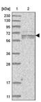 Polypeptide N-Acetylgalactosaminyltransferase Like 6 antibody, PA5-56616, Invitrogen Antibodies, Western Blot image 