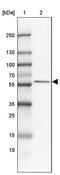 Family With Sequence Similarity 189 Member A1 antibody, PA5-52717, Invitrogen Antibodies, Western Blot image 