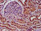 Solute Carrier Family 34 Member 3 antibody, LS-C672657, Lifespan Biosciences, Immunohistochemistry paraffin image 