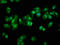 26S proteasome non-ATPase regulatory subunit 11 antibody, LS-C211225, Lifespan Biosciences, Immunofluorescence image 