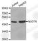Nudix Hydrolase 6 antibody, A0260, ABclonal Technology, Western Blot image 