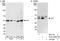 Integrin-linked protein kinase antibody, A301-258A, Bethyl Labs, Immunoprecipitation image 