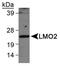 LIM Domain Only 2 antibody, NB110-83978, Novus Biologicals, Western Blot image 