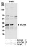 Capping Actin Protein Of Muscle Z-Line Subunit Beta antibody, A304-734A, Bethyl Labs, Immunoprecipitation image 