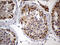 ZFP57 Zinc Finger Protein antibody, M07563, Boster Biological Technology, Immunohistochemistry paraffin image 