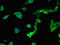 Pleckstrin Homology Domain Containing A7 antibody, orb46395, Biorbyt, Immunocytochemistry image 