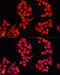 4-trimethylaminobutyraldehyde dehydrogenase antibody, 23-245, ProSci, Immunofluorescence image 
