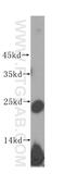60S ribosomal protein L10 antibody, 17013-1-AP, Proteintech Group, Western Blot image 
