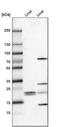 FKBP Prolyl Isomerase 11 antibody, PA5-59687, Invitrogen Antibodies, Western Blot image 
