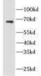 Ecotropic Viral Integration Site 2B antibody, FNab02886, FineTest, Western Blot image 