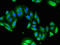 Ubiquitin Specific Peptidase 6 antibody, orb51134, Biorbyt, Immunocytochemistry image 