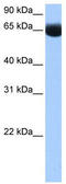 NOP2/Sun RNA Methyltransferase 6 antibody, TA344029, Origene, Western Blot image 