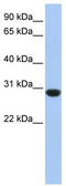 Ankyrin Repeat And SOCS Box Containing 12 antibody, TA340255, Origene, Western Blot image 