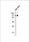 SHQ1, H/ACA Ribonucleoprotein Assembly Factor antibody, PA5-72672, Invitrogen Antibodies, Western Blot image 