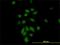 Nuclear Mitotic Apparatus Protein 1 antibody, H00004926-M01, Novus Biologicals, Immunocytochemistry image 