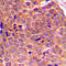 Akt antibody, LS-C351807, Lifespan Biosciences, Immunohistochemistry paraffin image 