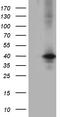 Uridine Phosphorylase 2 antibody, CF812319, Origene, Western Blot image 