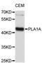 Phospholipase A1 Member A antibody, abx127010, Abbexa, Western Blot image 