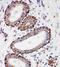 COXI antibody, PA1317-1, Boster Biological Technology, Immunohistochemistry paraffin image 