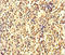 Ankyrin Repeat And Death Domain Containing 1A antibody, LS-C395238, Lifespan Biosciences, Immunohistochemistry paraffin image 