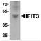Interferon Induced Protein With Tetratricopeptide Repeats 3 antibody, TA349042, Origene, Western Blot image 